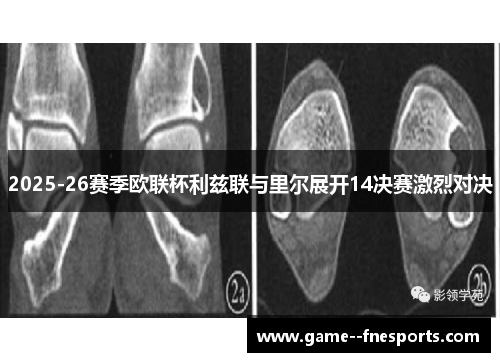 2025-26赛季欧联杯利兹联与里尔展开14决赛激烈对决